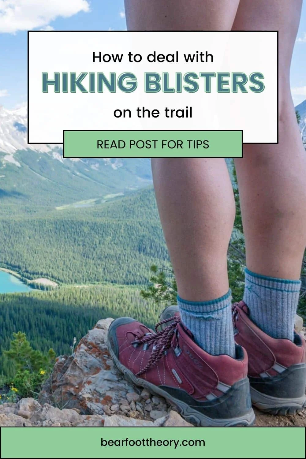 How to Prevent & Treat Hiking Blisters on the Trail